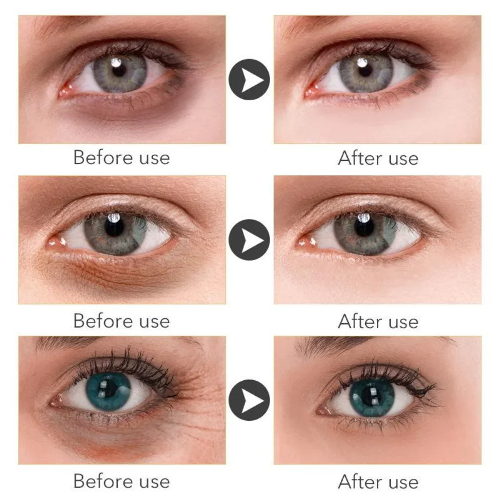 Retinol Anti-aging Whitening Serum