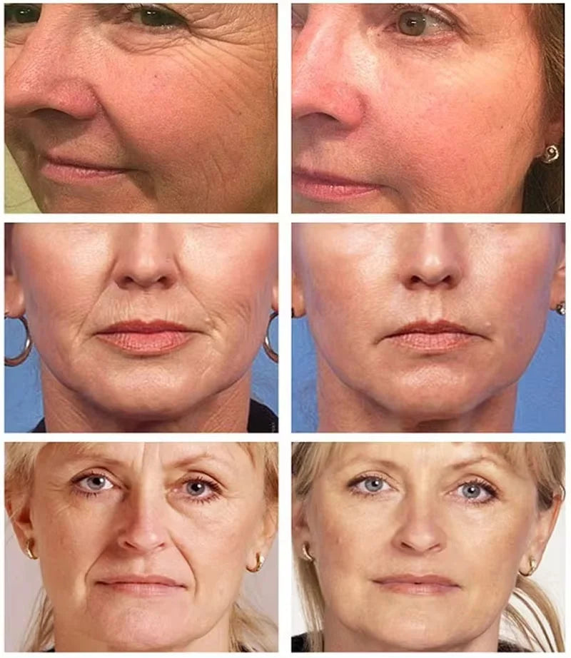 Retinol Wrinkle Remover Face Serum