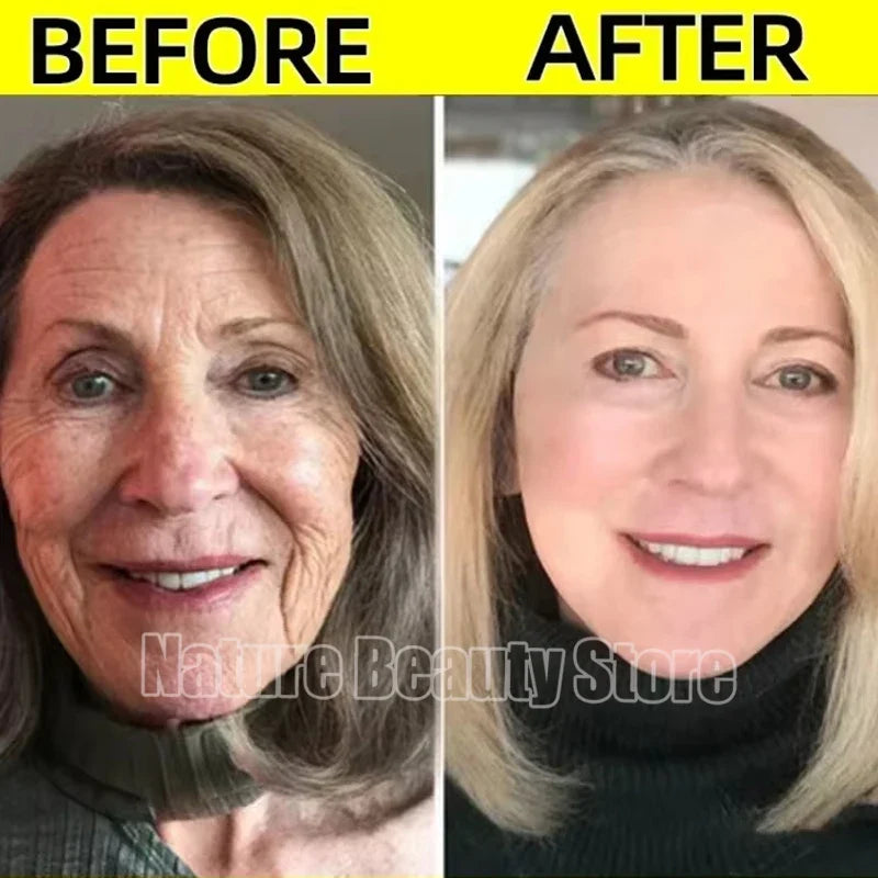 Retinol Wrinkle Remover Face Serum